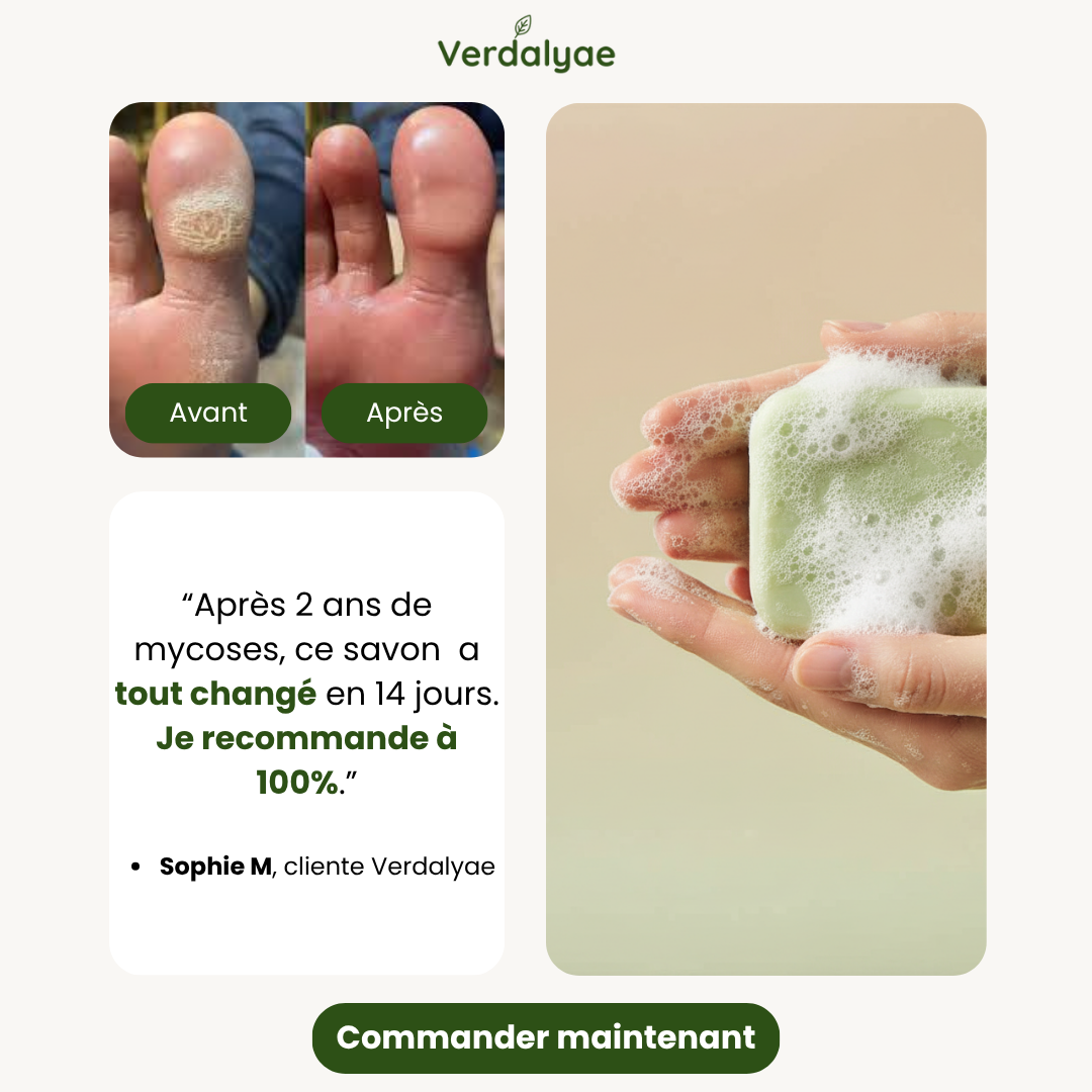 Verdalyae Facebook ad