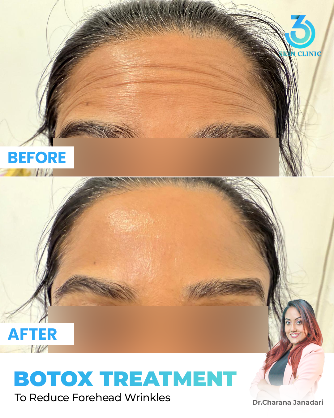 360 Skin Clinic Facebook ad: වයස කියන්නේ හුදෙක් ඉලක්කමක් පමණක් බව ලොවට පෙන්වන්න!