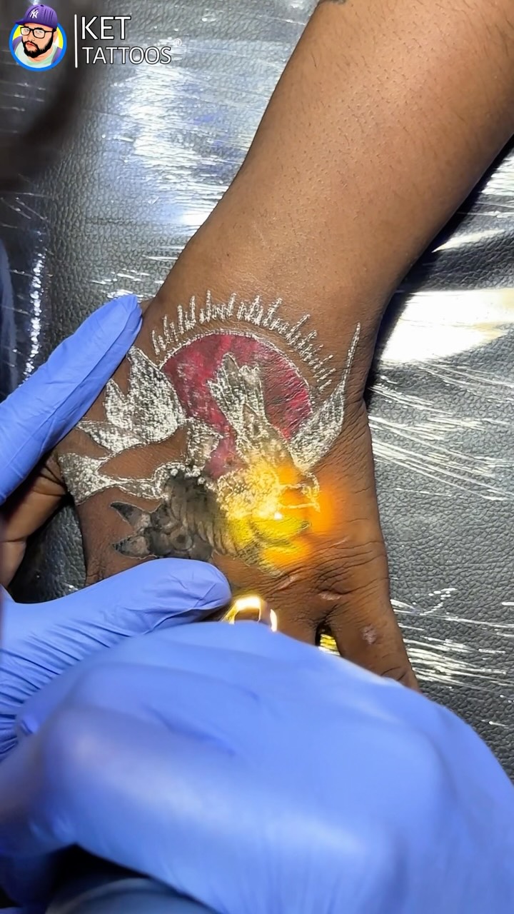 Ket Tattoos Facebook ad: Tattoo Removal isnβt a one-day process, PATIENCE isβ¦