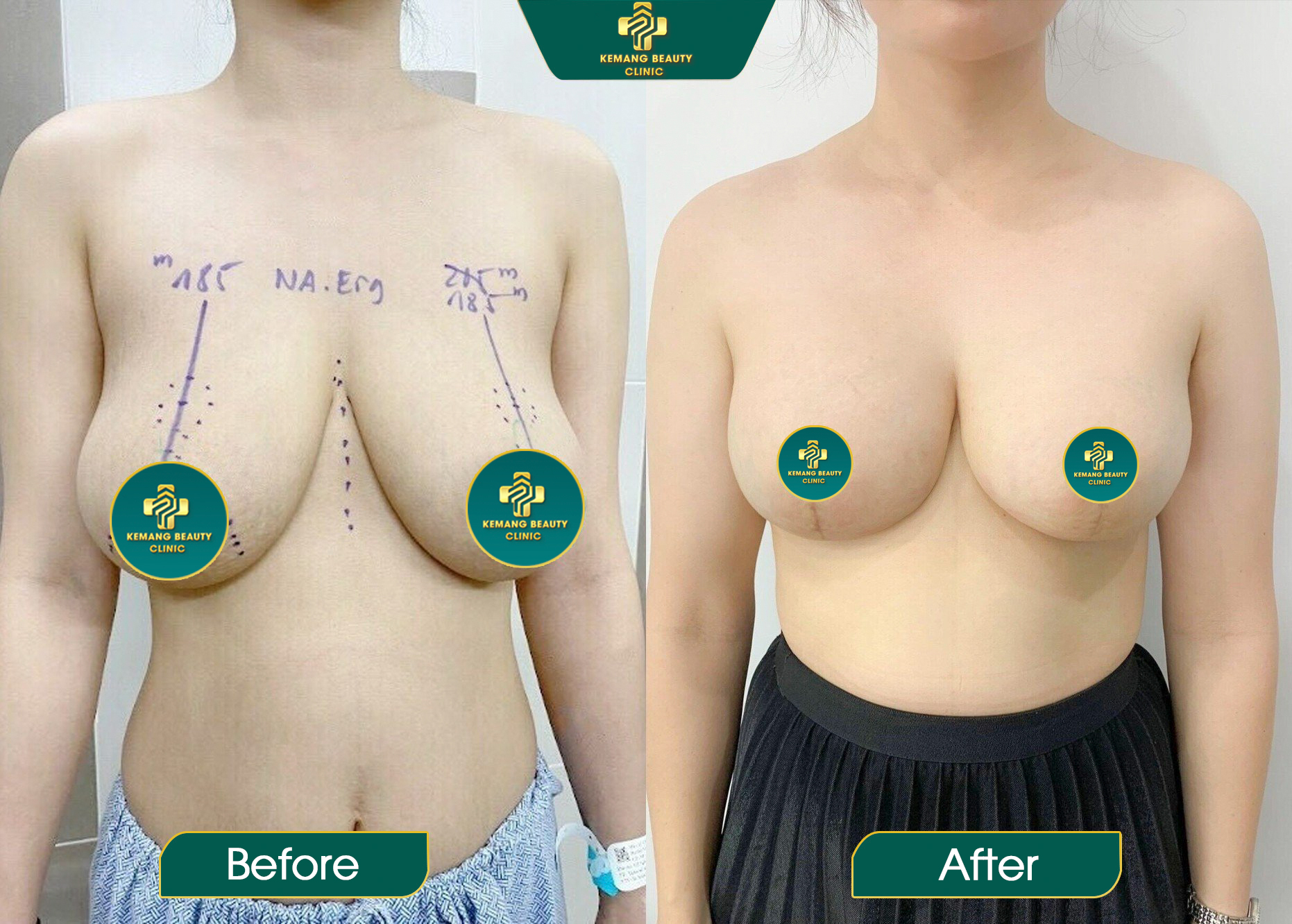 Kemang Beauty Clinic Facebook ad