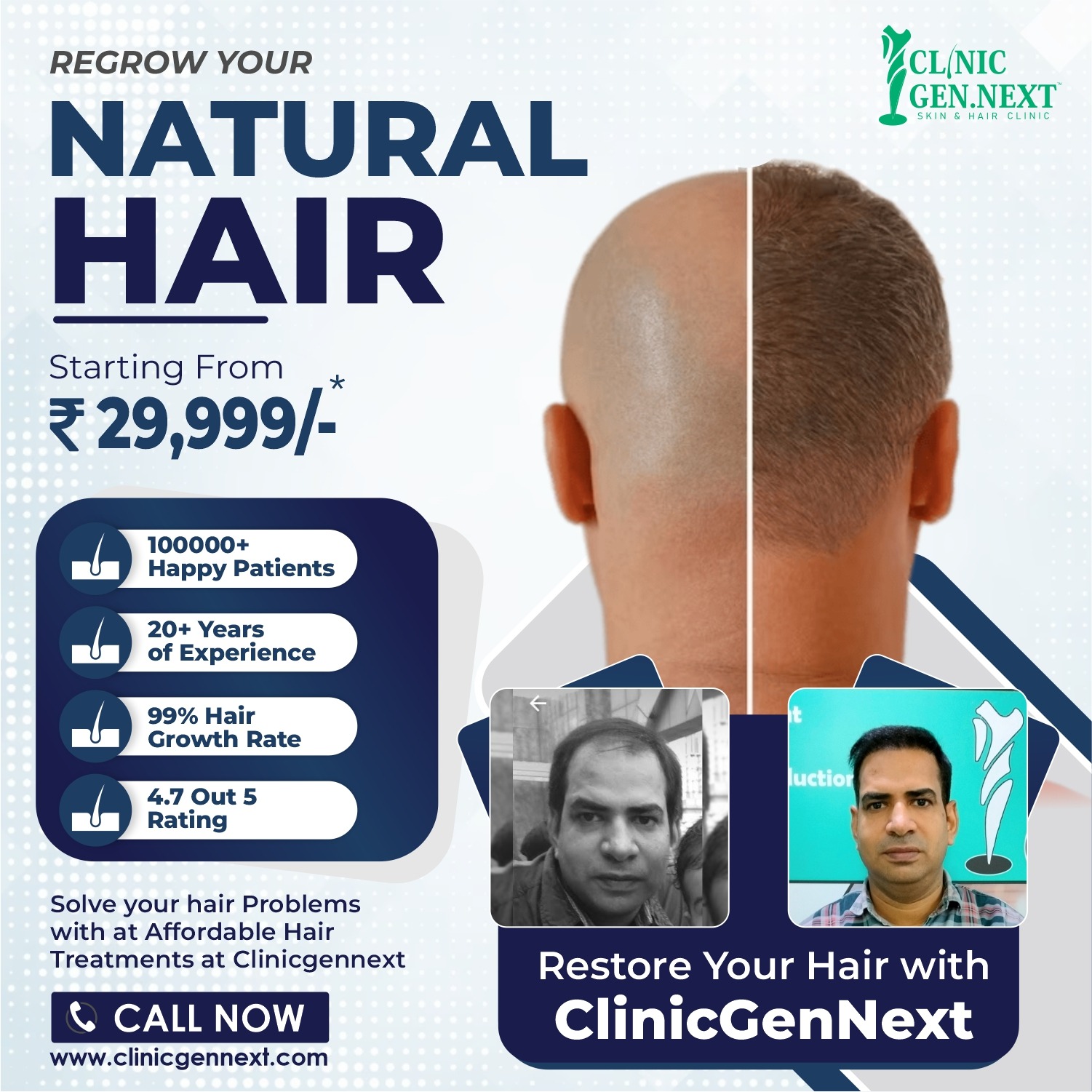 Clinic Gennext Skin & Hair Clinic Lucknow Facebook ad from Mar 16, 2026