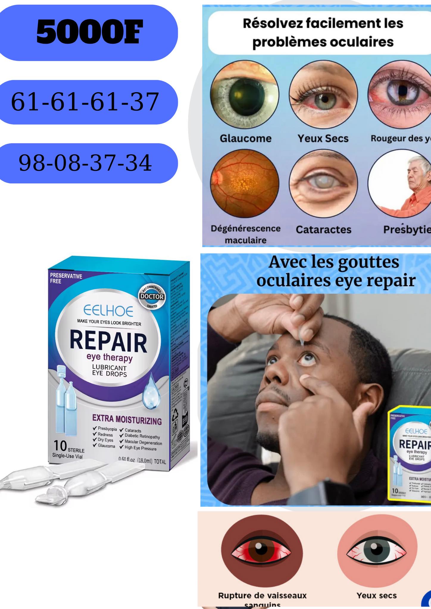 Tb global Facebook ad: Au Tchad