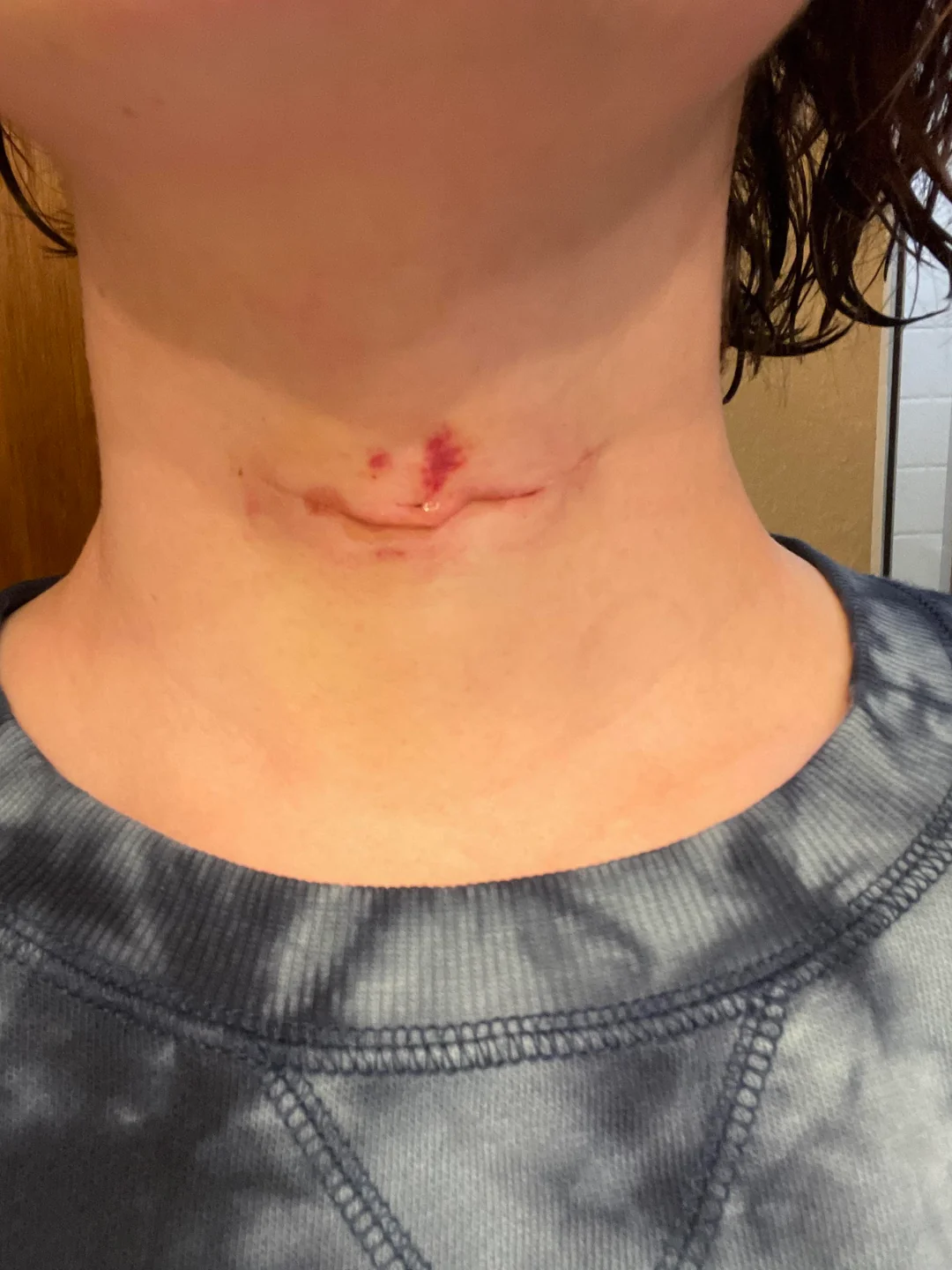 Thyroid Health Daily Facebook ad: Read this if you're scared to take GLP-1