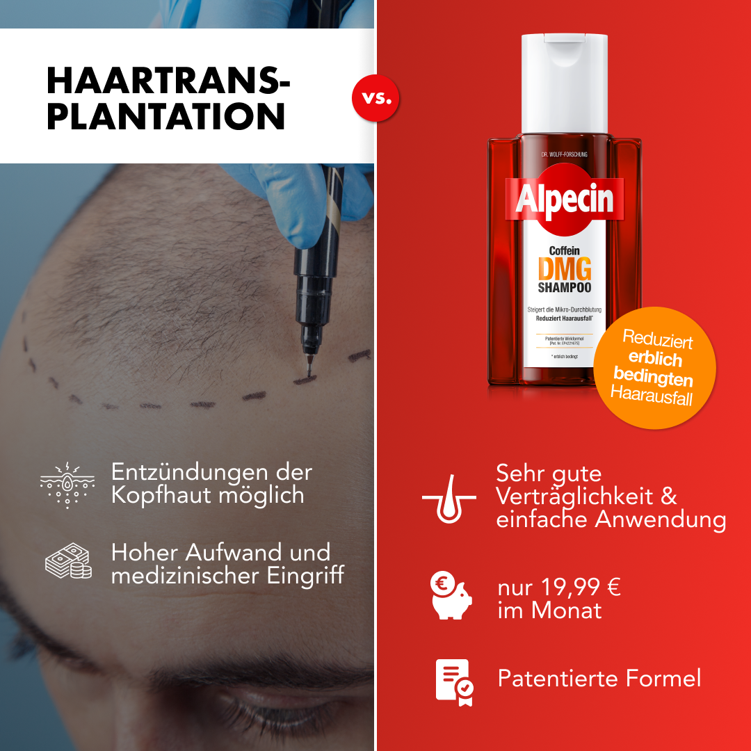 Alpecin Facebook ad