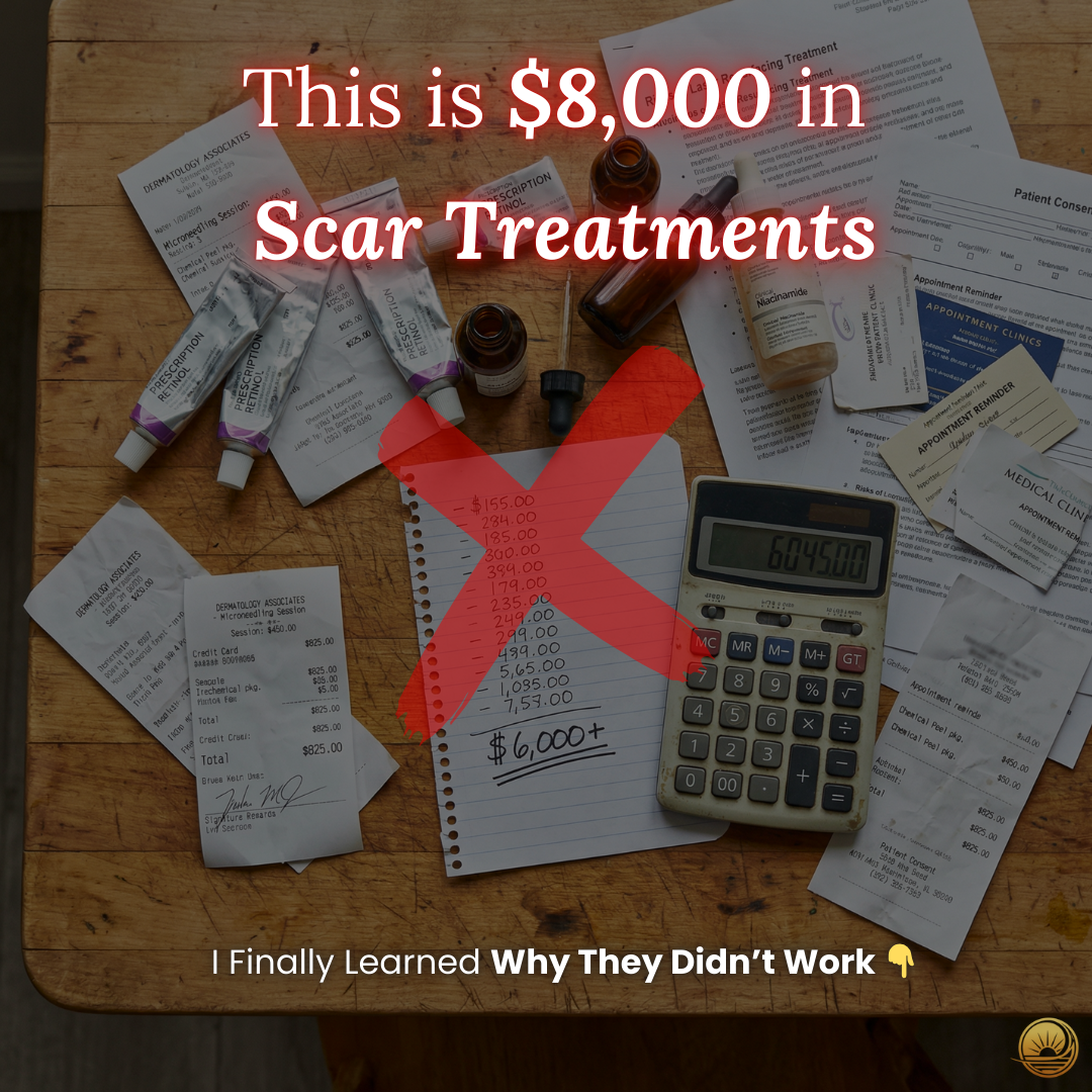 Terraura Facebook ad: Why Your Scar Treatments Keep Failing