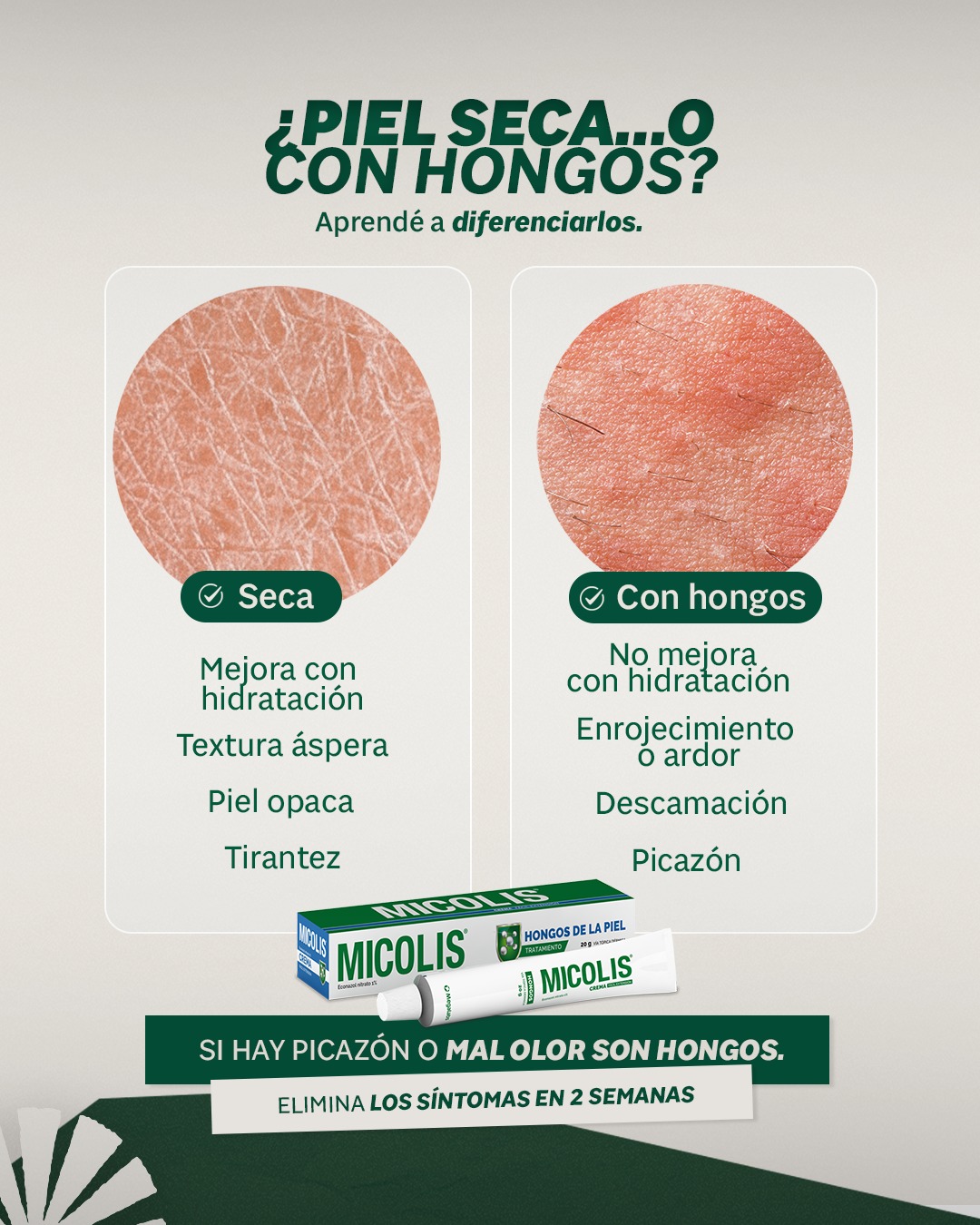 Micolis Uruguay Facebook ad: La piel seca puede confundirse con hongos, pero