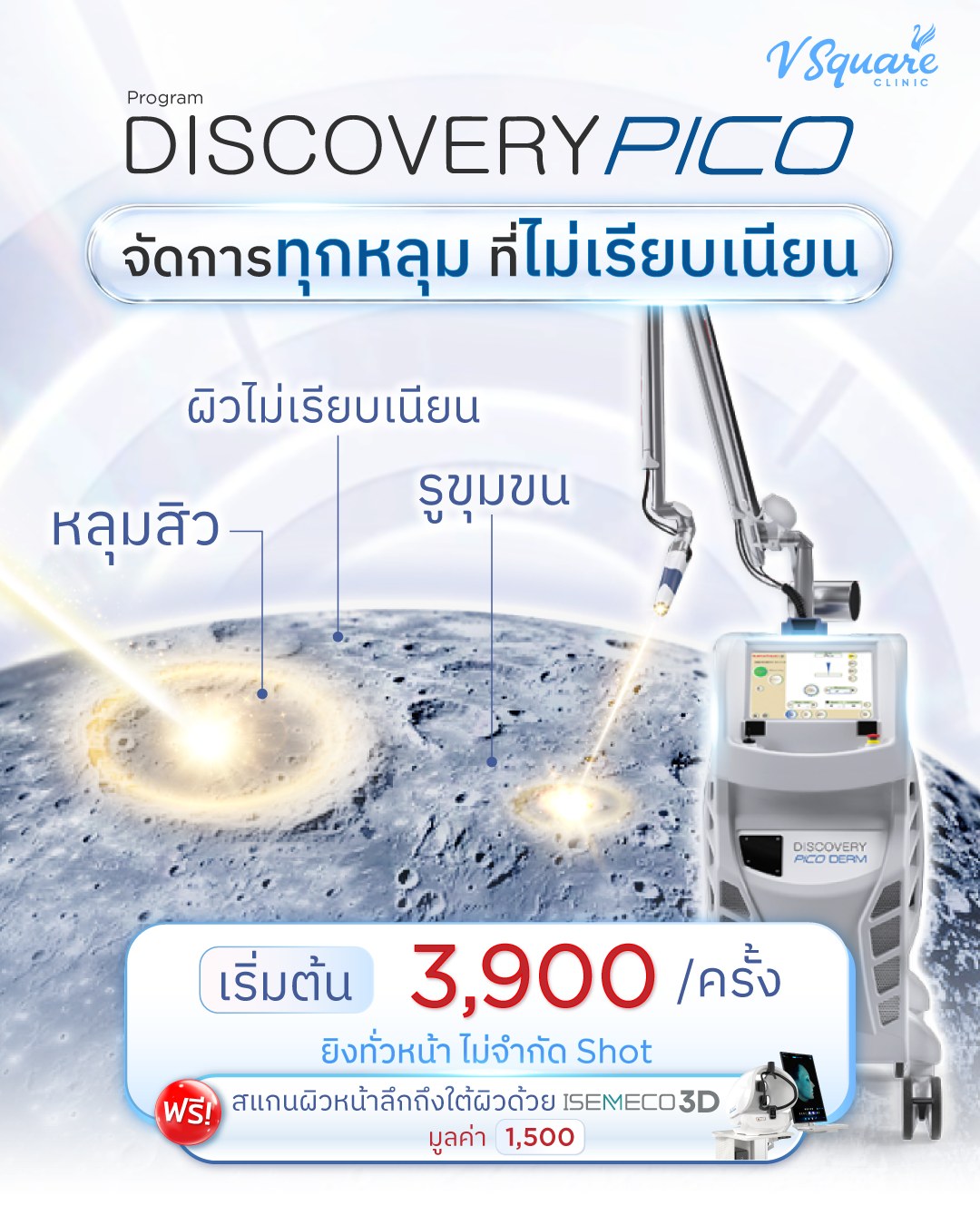 V Square Pico laser ฝ้า กระ หลุมสิว หน้าใส Facebook ad