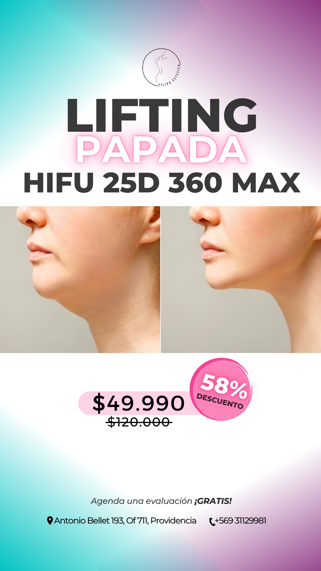 filipaestetica.cl Facebook ad from Dec 16, 2025