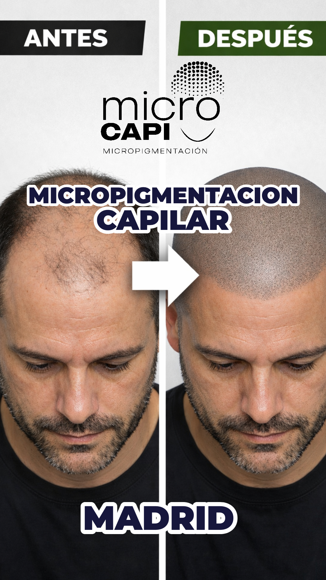 MicroCapi Madrid Facebook ad from Mar 16, 2026