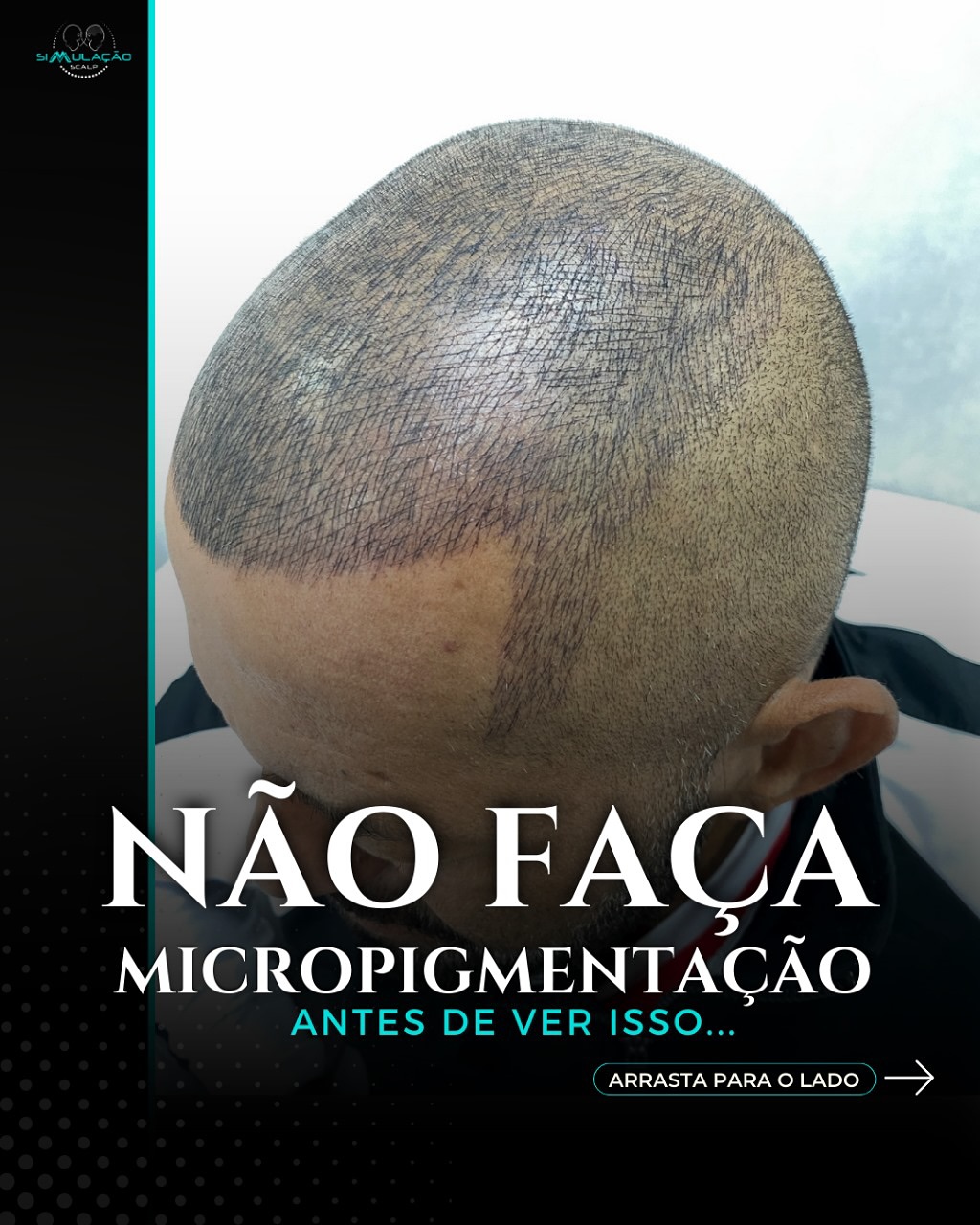 Simulação Scalp  Facebook ad