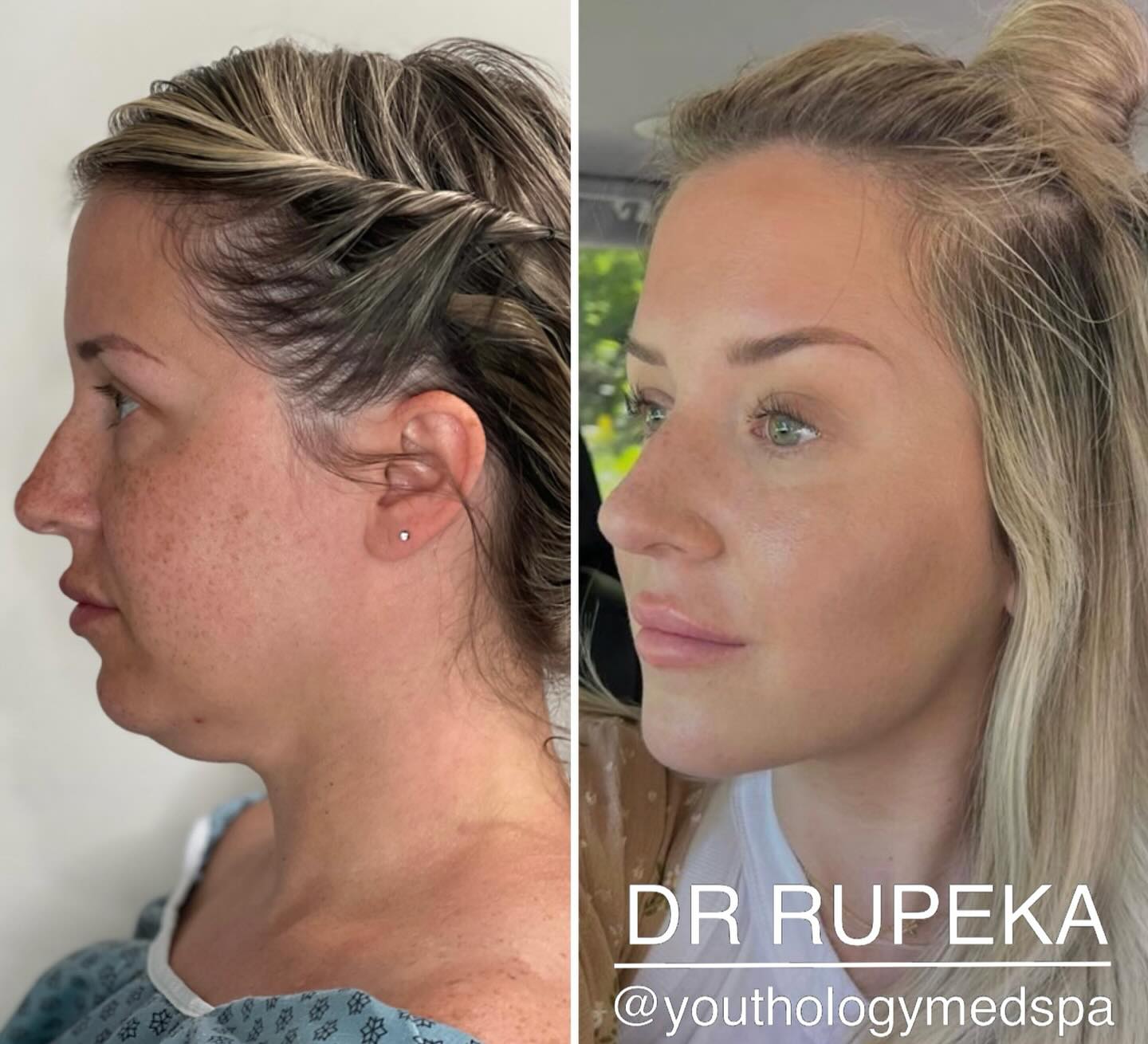 Youthology Medspa Facebook ad