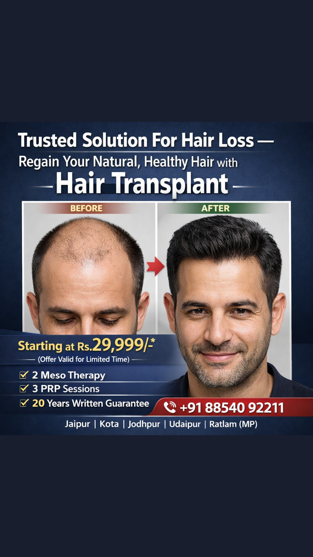 Best hair Transplant in Rajsthan-Udaypur-Kota,Jodhpur,Jaipur Facebook ad