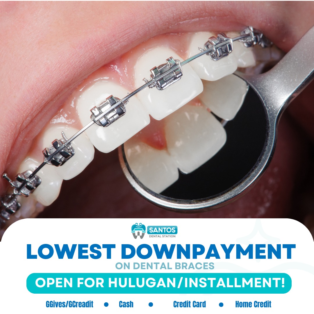 Santos Dental Station Facebook ad