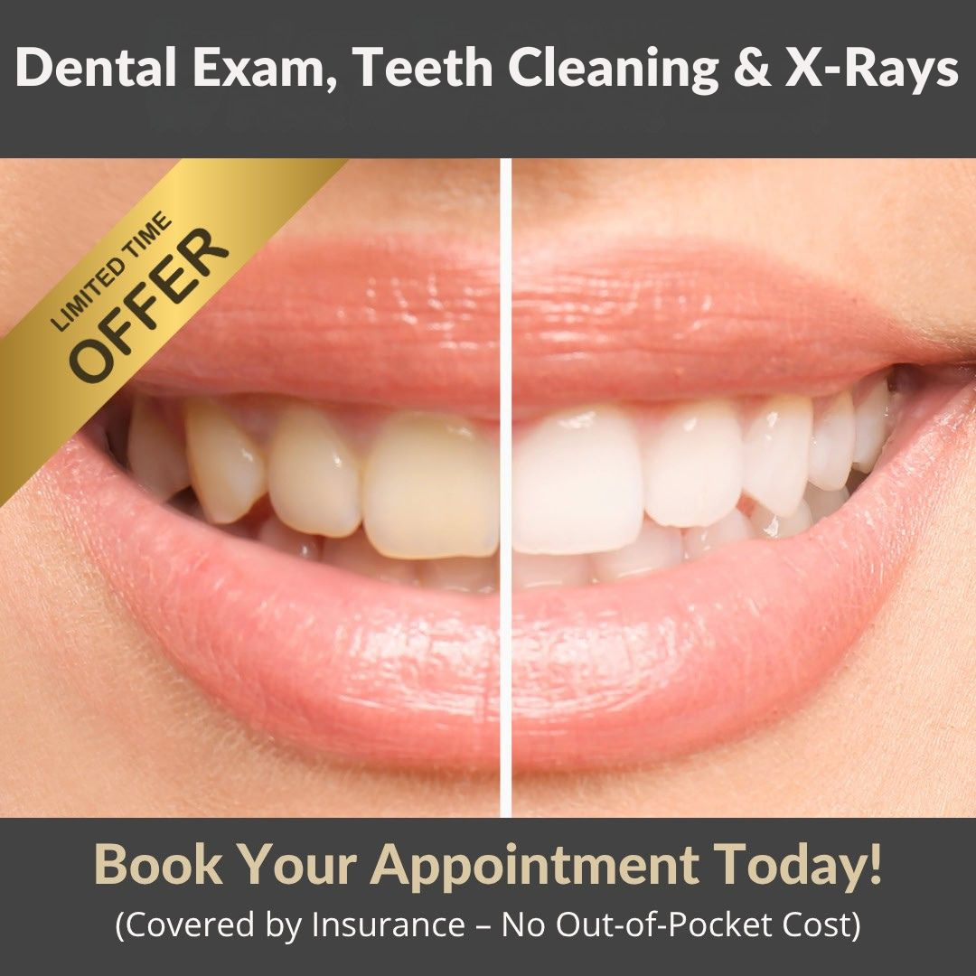 Belle Smile Dental Facebook ad: FREE Teeth Whitening Kit