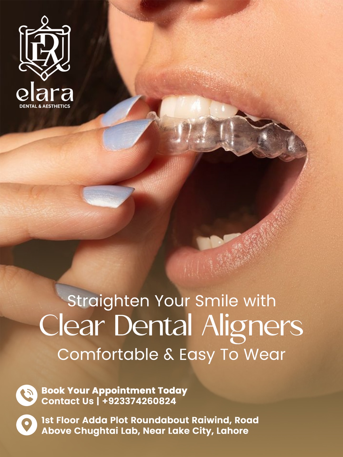 Elara Dental & Aesthetics  Facebook ad