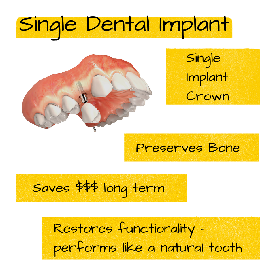 Sunset Valley Dental Facebook ad: Smile, laugh with confidence, and eat WHATEVER you…