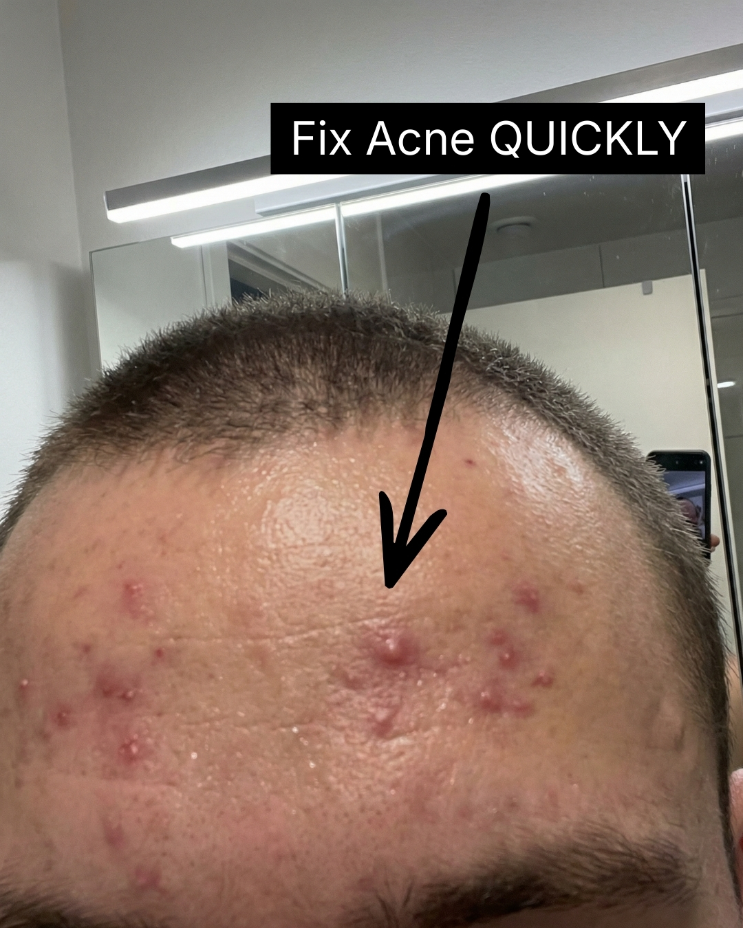 Frasé Skin Facebook ad