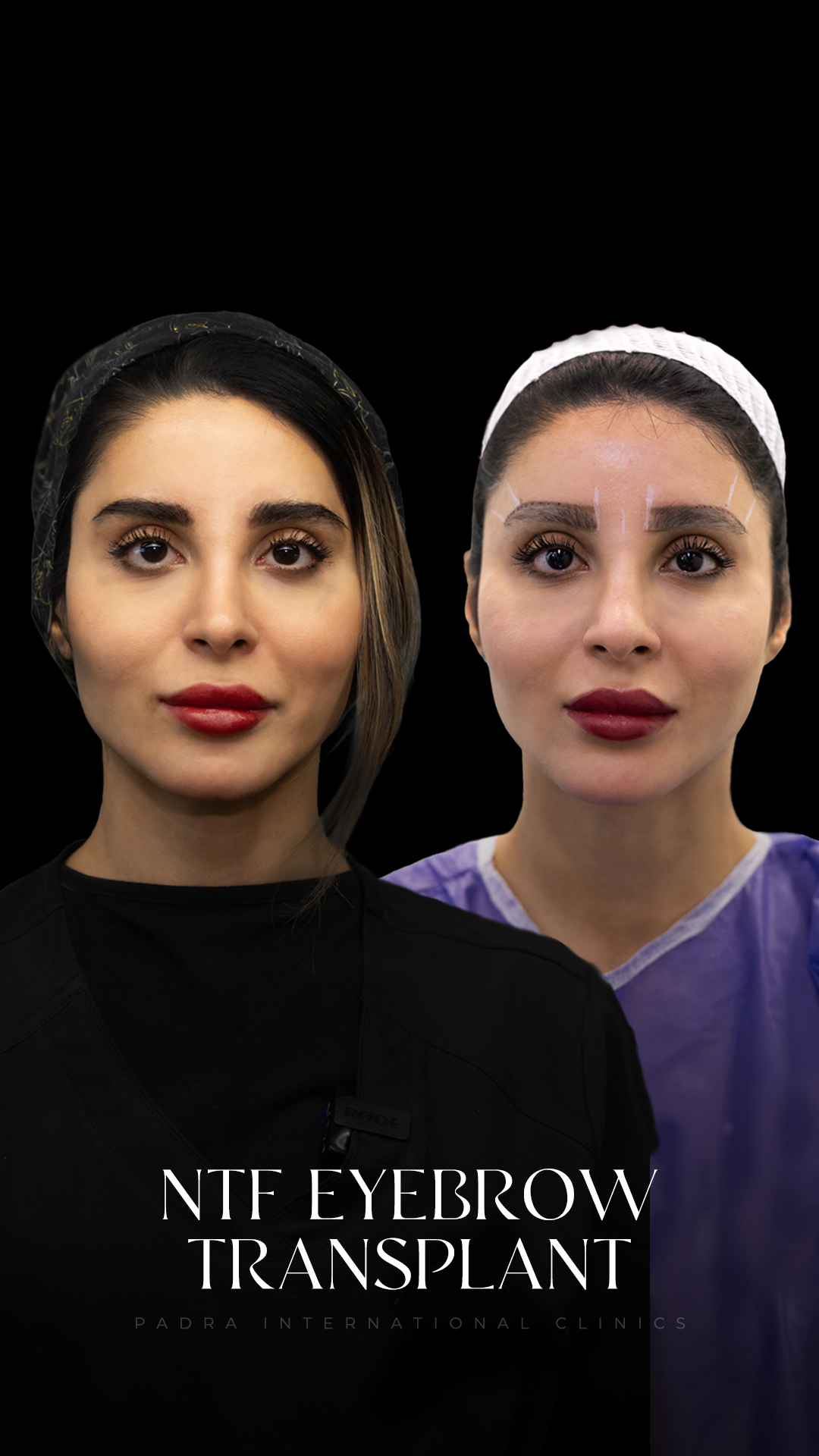 Padra Clinic Qatar Facebook ad