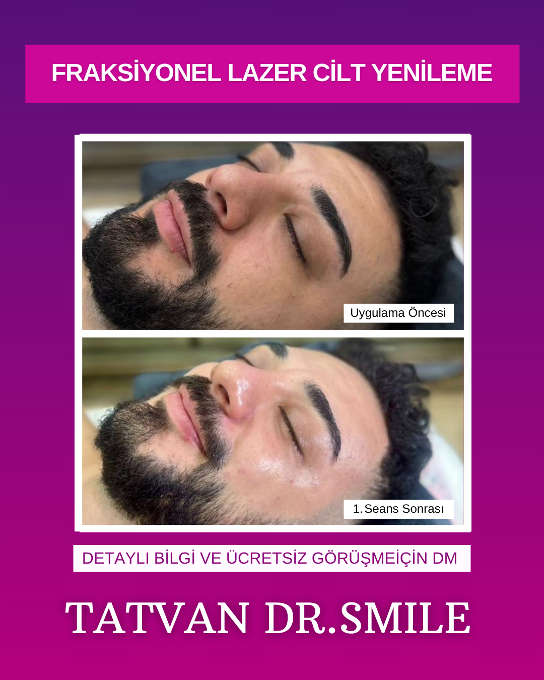 Drsmile.tatvan Facebook ad: Dr Smile Tatvan