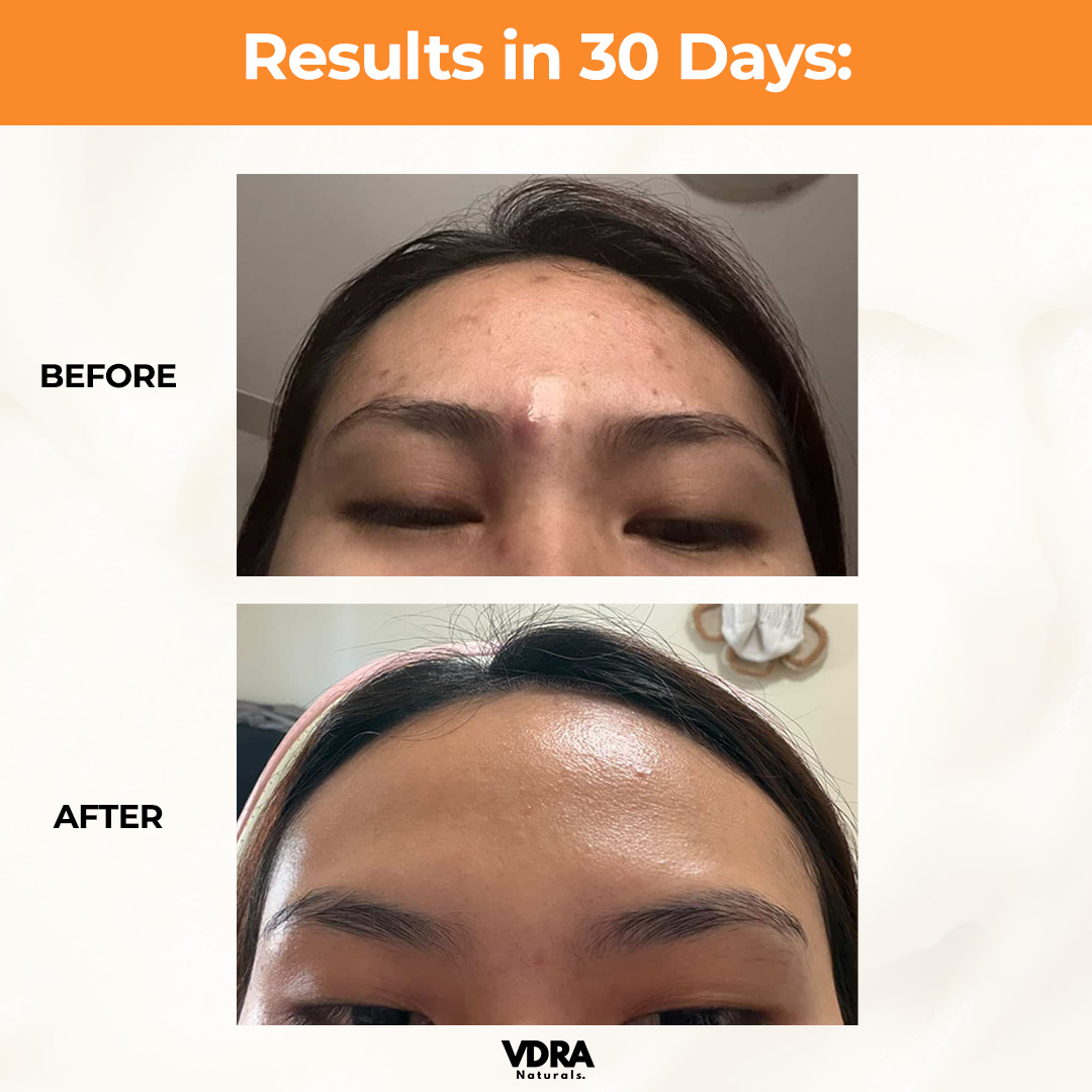 VDRA Naturals - Ayurvedic Skincare Facebook ad