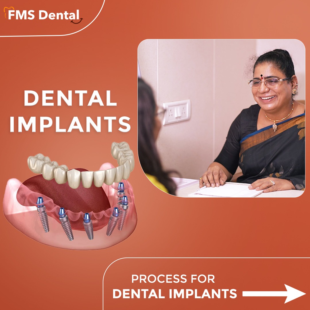 FMS International Dental Center Facebook ad: Real smile transformations require world-class expertise.