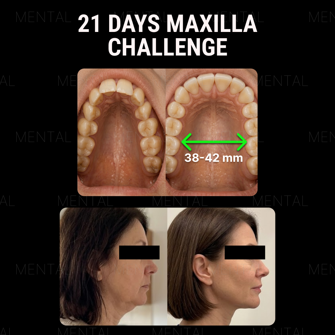 Mimika - Face Yoga Exercises Facebook ad