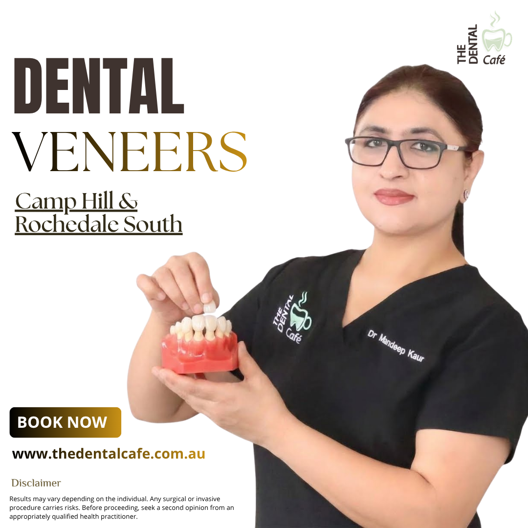 The Dental Cafe Camp Hill & Rochedale South Facebook ad: Dental Veneers Brisbane
