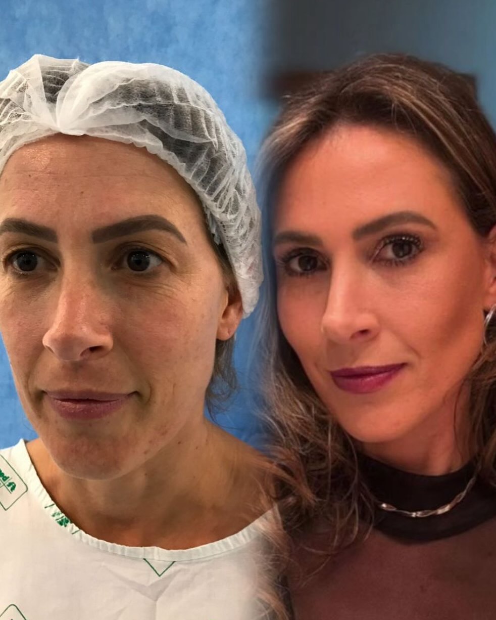 Dra. Melissa Krindges Facebook ad: O TEMPO PASSA, MAS SEU OLHAR NÃO PRECISA…