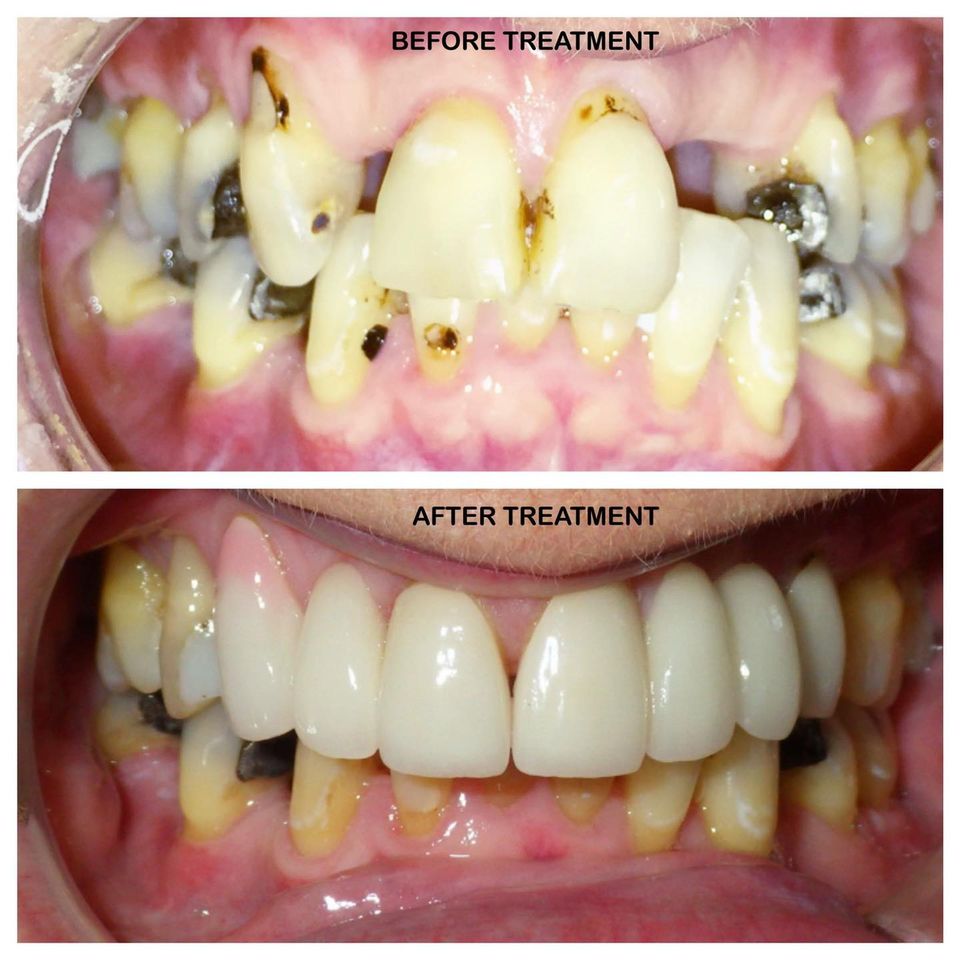 Ardmore Dental Facebook ad: WE PROVIDE FREE INITIAL CONSULTATION.
