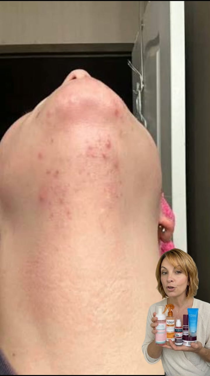 Dr.Melaxin US.official Facebook ad: I Stopped Ignoring 90% Of My Skin. Best Decision I've Made.
