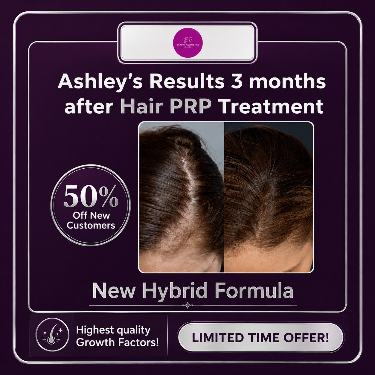BR Beauty Aesthetics Facebook ad: 50% OFF Hair PRP, Stimulate Hair Growth the Natural Way!