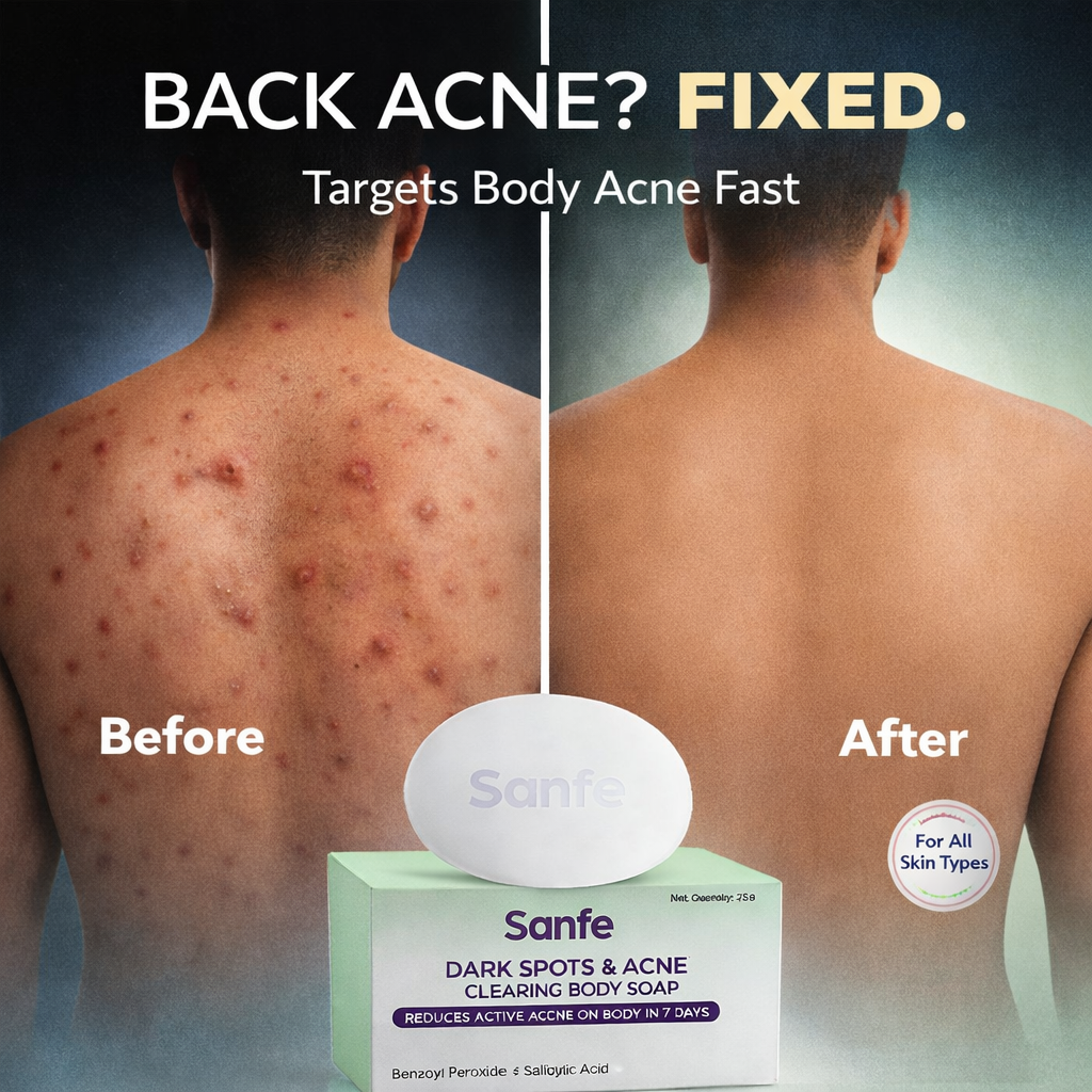 Sanfe India Facebook ad