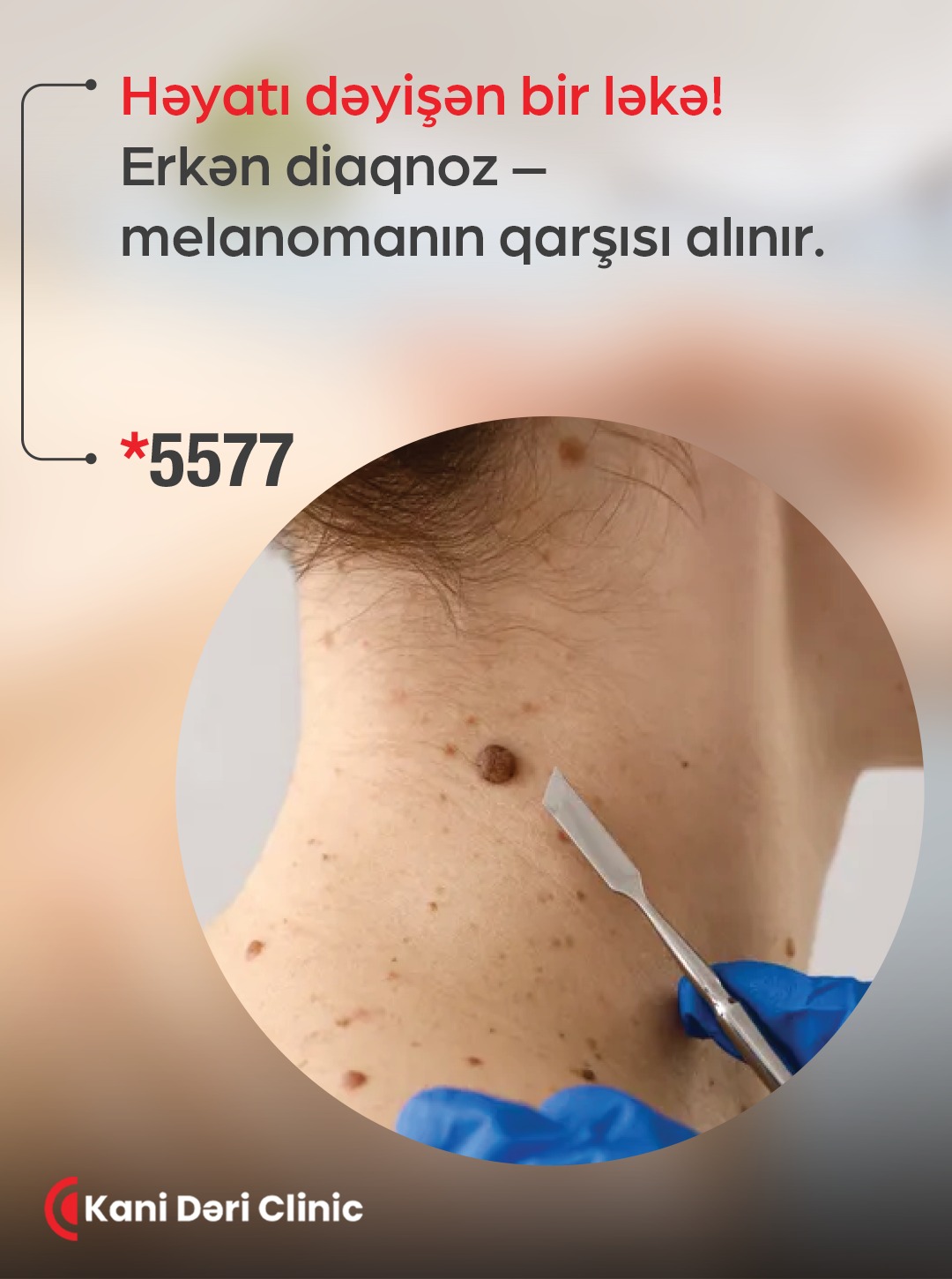 Kani Dəri Clinic Facebook ad: Müayinəni gecikdirməyin, risk olduqda zaman sizin…