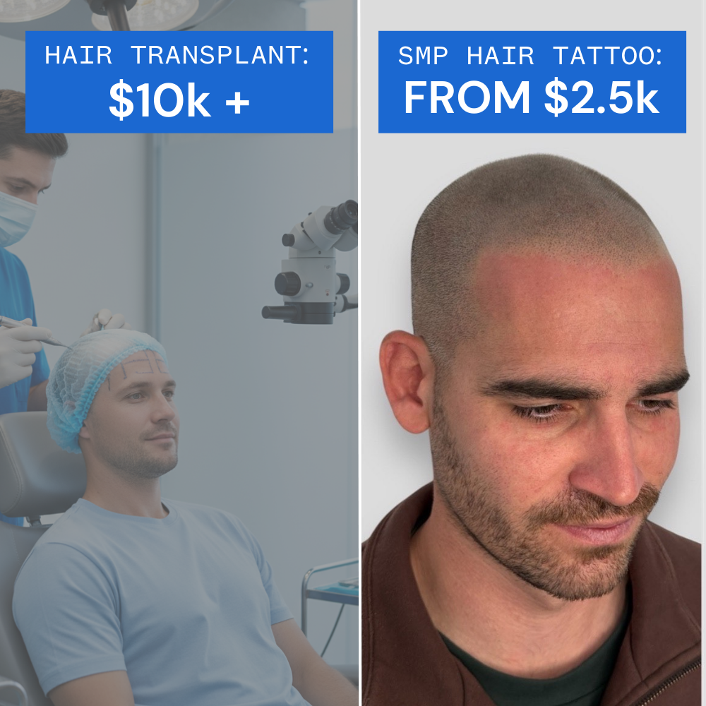 SMP HQ - Scalp Micropigmentation Clinic Facebook ad: Same Confidence For Less Than Half The Cost