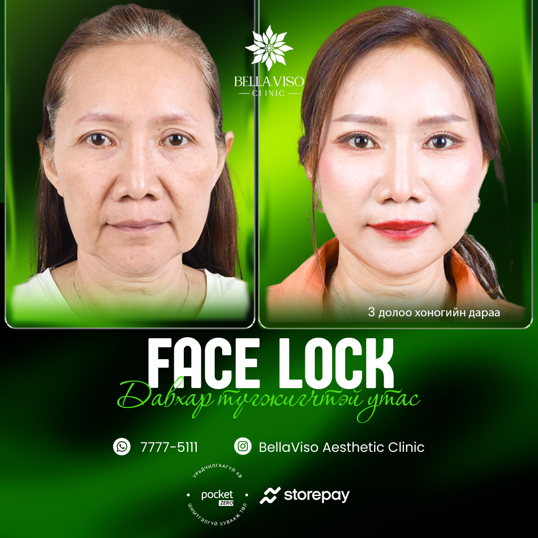 Bella Viso Clinic Facebook ad