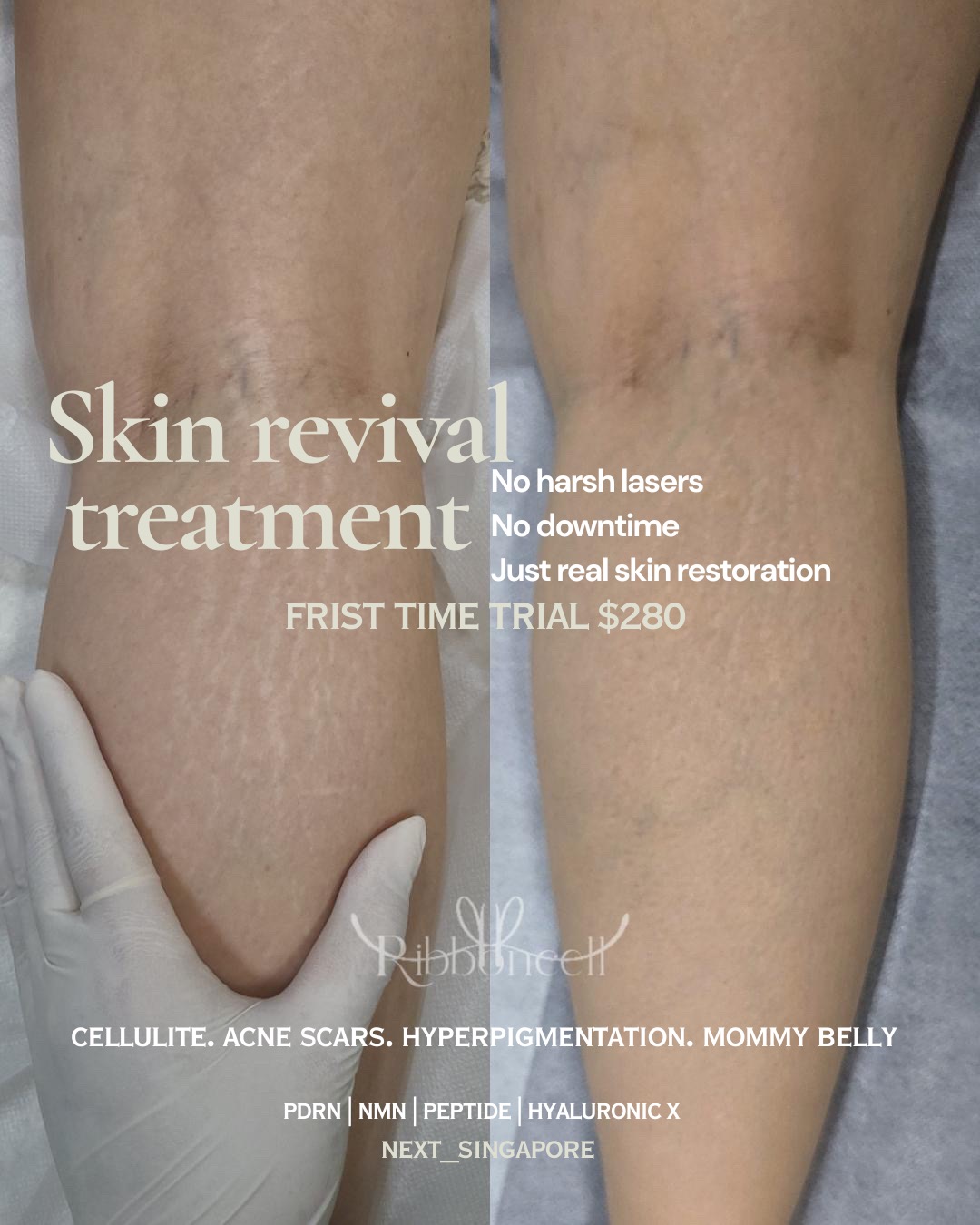 Next 1st Korea Scalp Micro-Pigmentation Facebook ad: Skin Revival Treatment