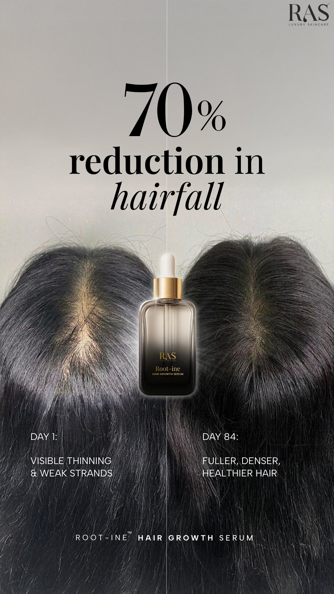 RAS Luxury Oils Facebook ad: Infinite Hair Growth Starts
