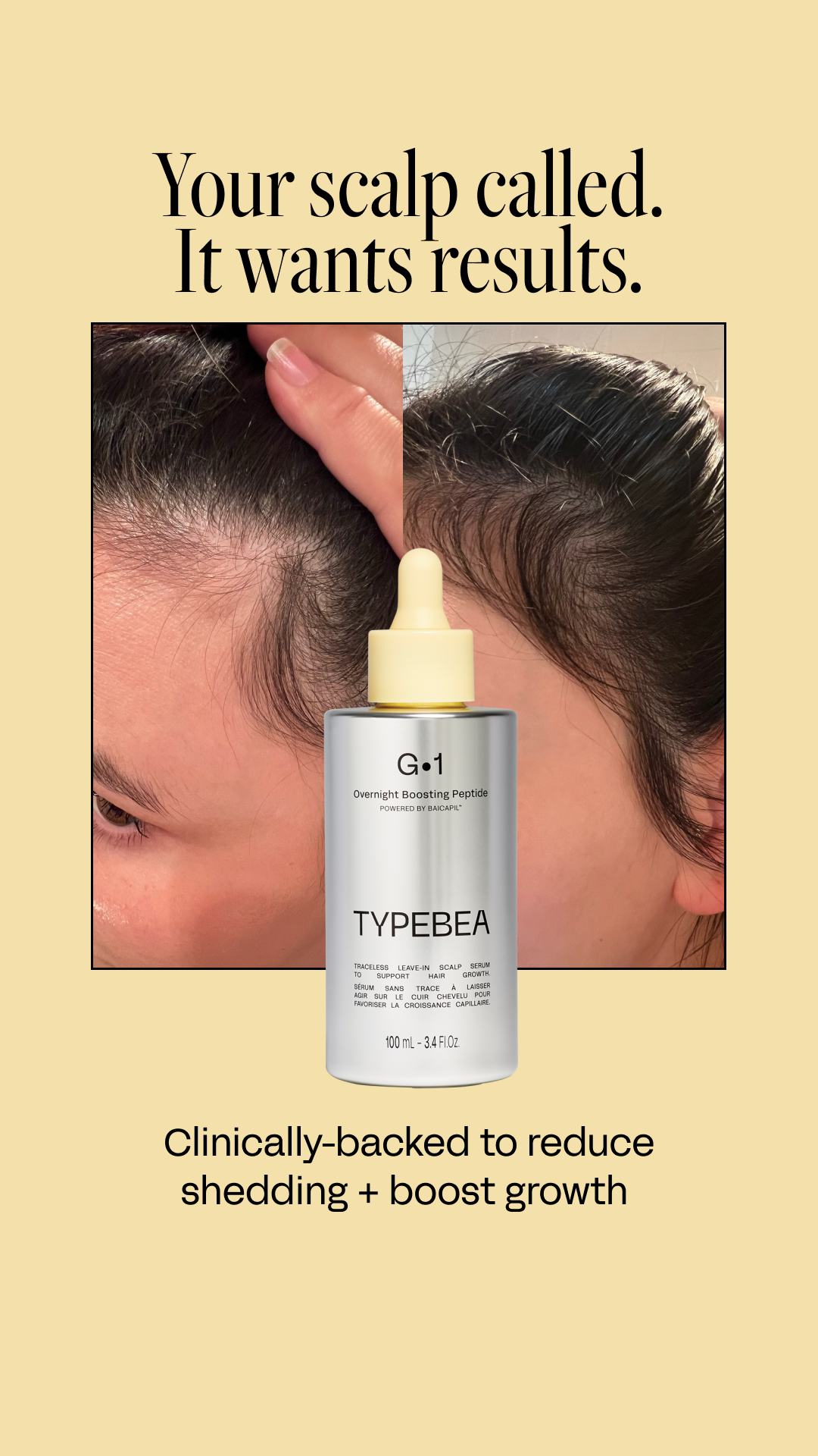 TYPEBEA Facebook ad