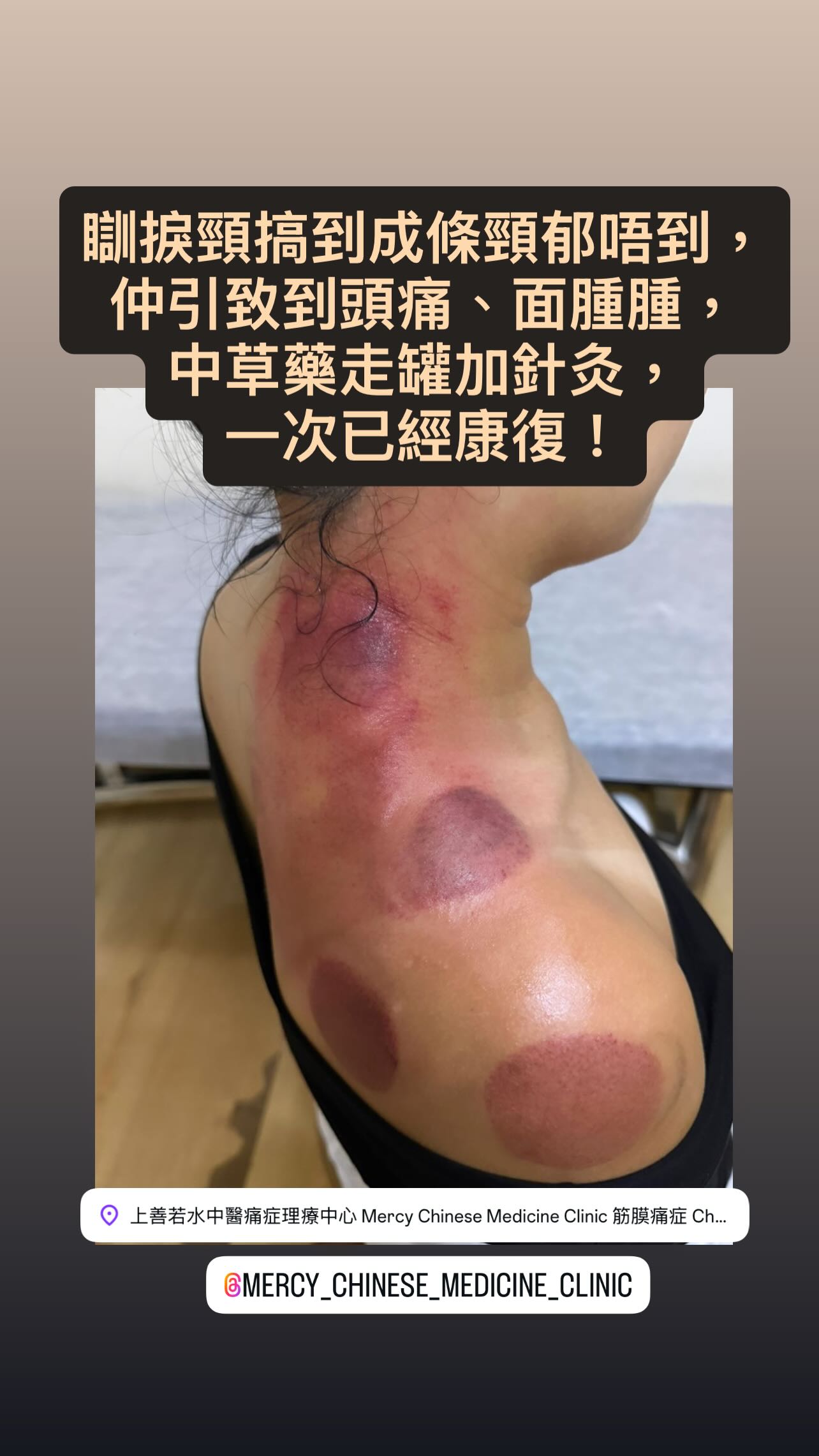 上善若水中醫痛症理療中心 Mercy Chinese Medicine Clinic 筋膜痛症 Chronic Pain Treatment Facebook ad