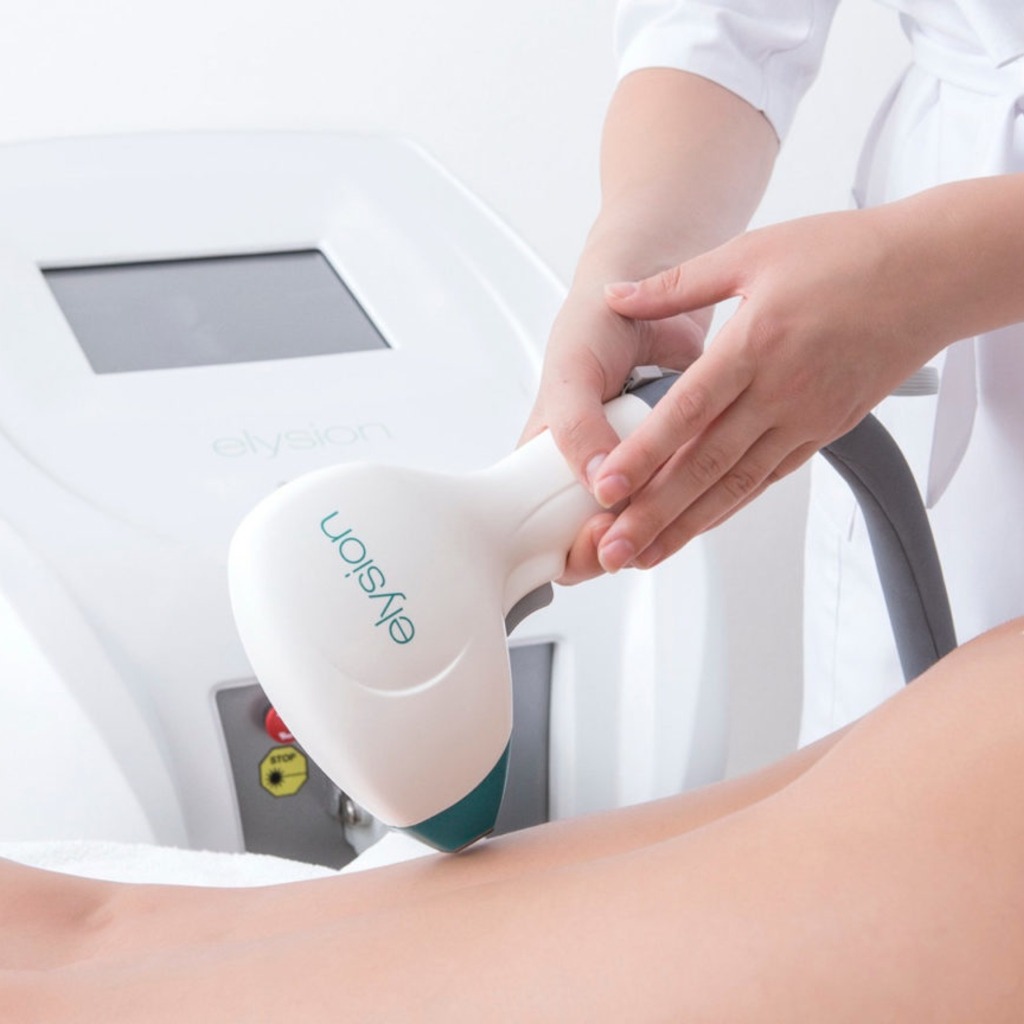 Glow Up Aesthetic Clinic Sopron Facebook ad