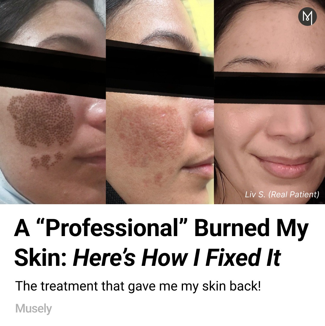 Musely FaceRx Facebook ad