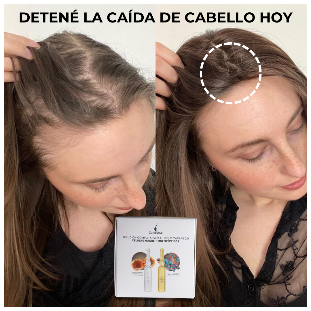 CapilNova Facebook ad: RESULTADOS O DEVOLUCION TOTAL