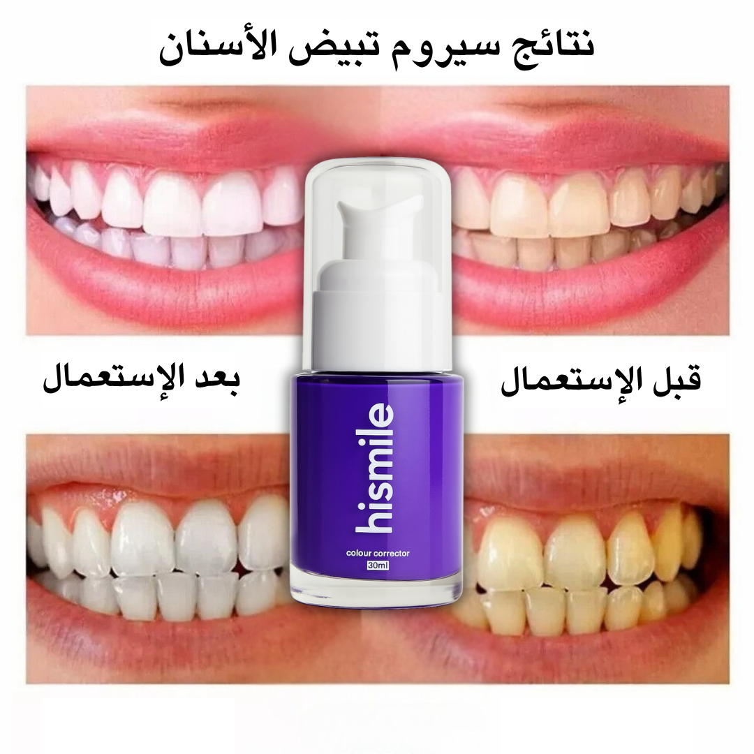 Hismile Facebook ad