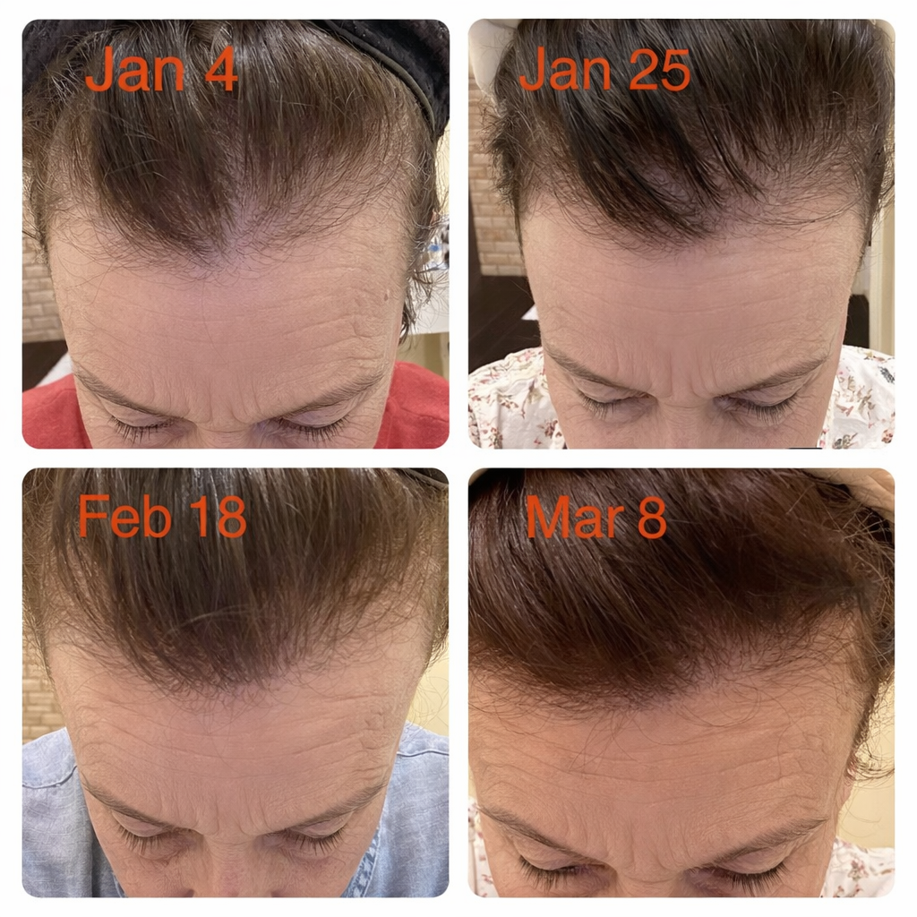 Ashwilliamms Facebook ad: Nurse shares what she found out GLP-1 hair loss