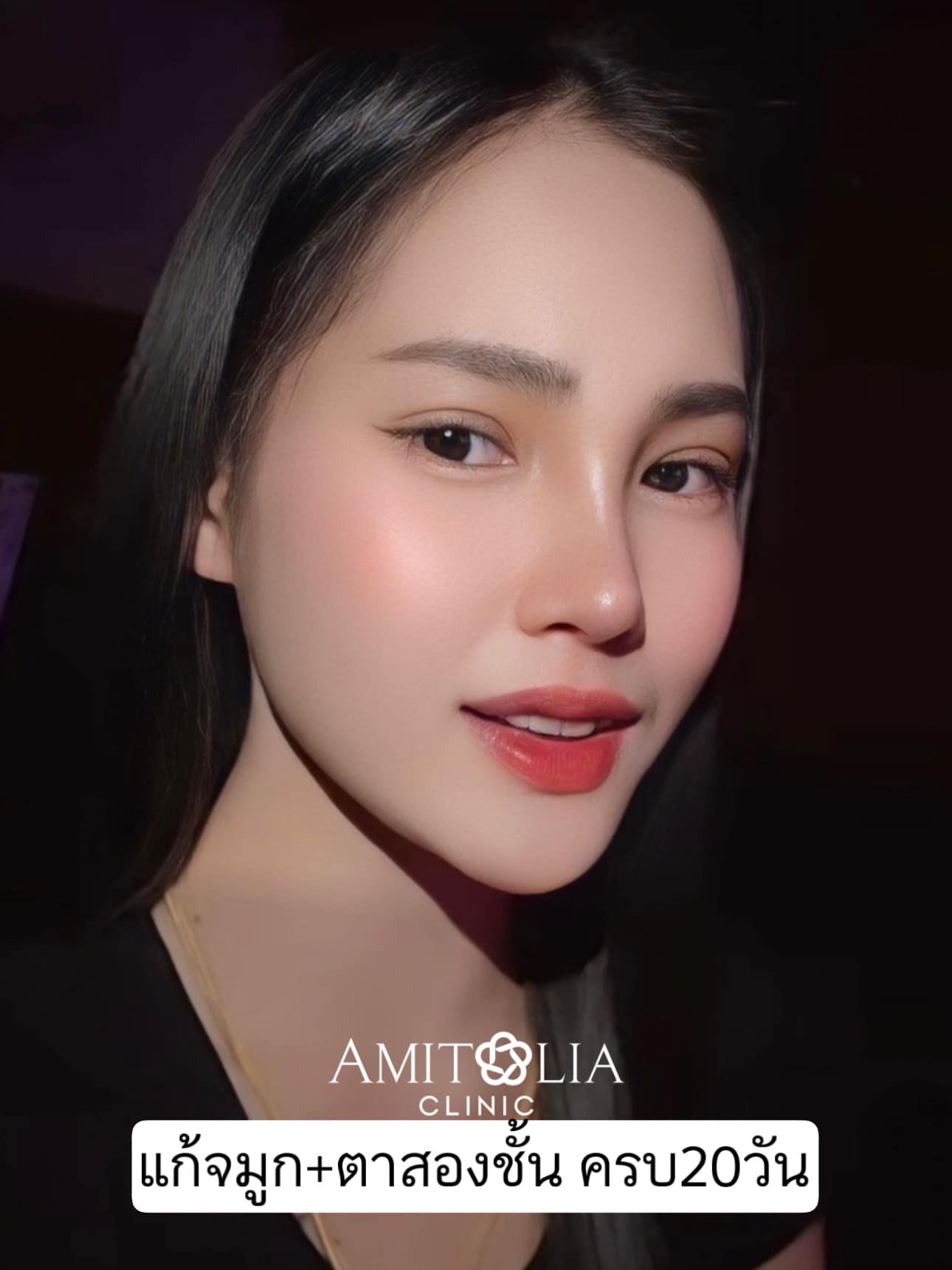 Amitalia Clinic Surgery & Aesthetic filler botox Facebook ad
