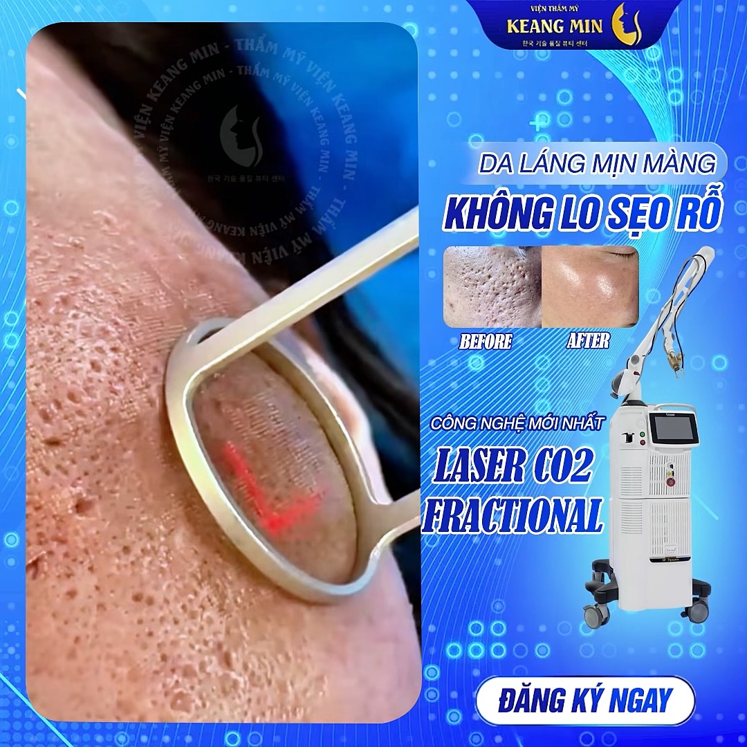 Trung Tâm Điều Trị Da Công Nghệ Cao KeangMin - 강민 미용실 Facebook ad: ĐÁNH BẠI SẸO RỖ TẬN GỐC VỚI LASER CO2 FRACTIONAL