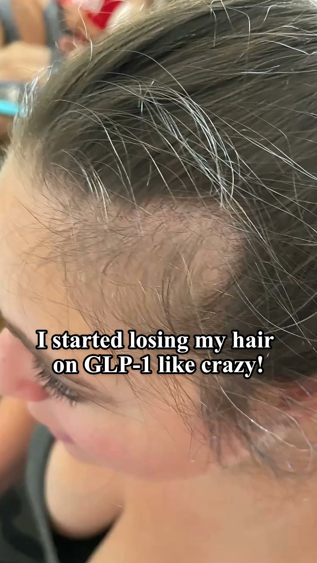 Bloom & Bond Facebook ad: Help Hair Loss Naturally