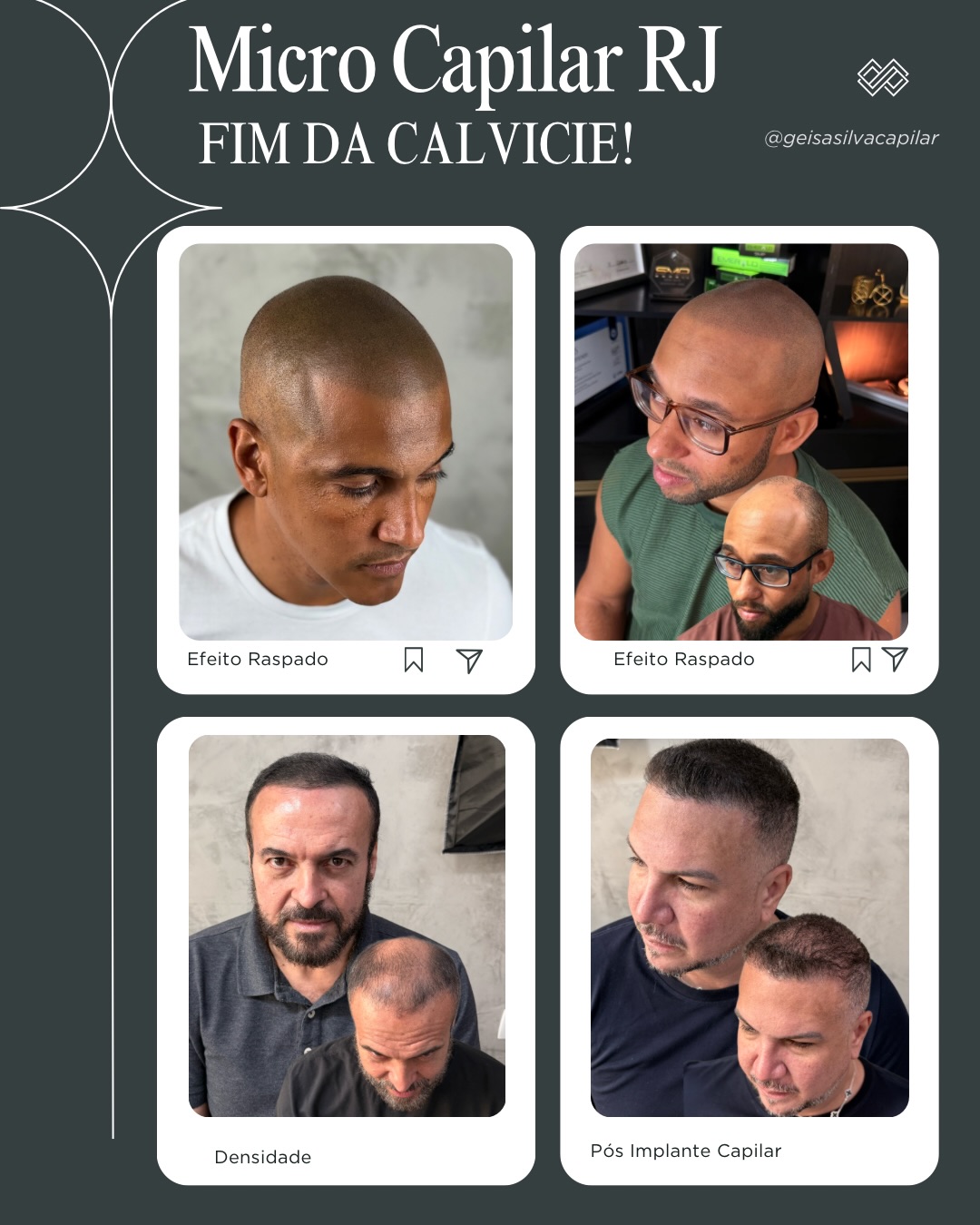 Geisa Silva - Micropigmentação Capilar Facebook ad: Chega de se incomodar com a calvície.