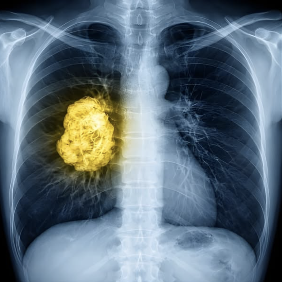 Natural Health Secrets Facebook ad: The COPD secret they’ve been hiding from you…