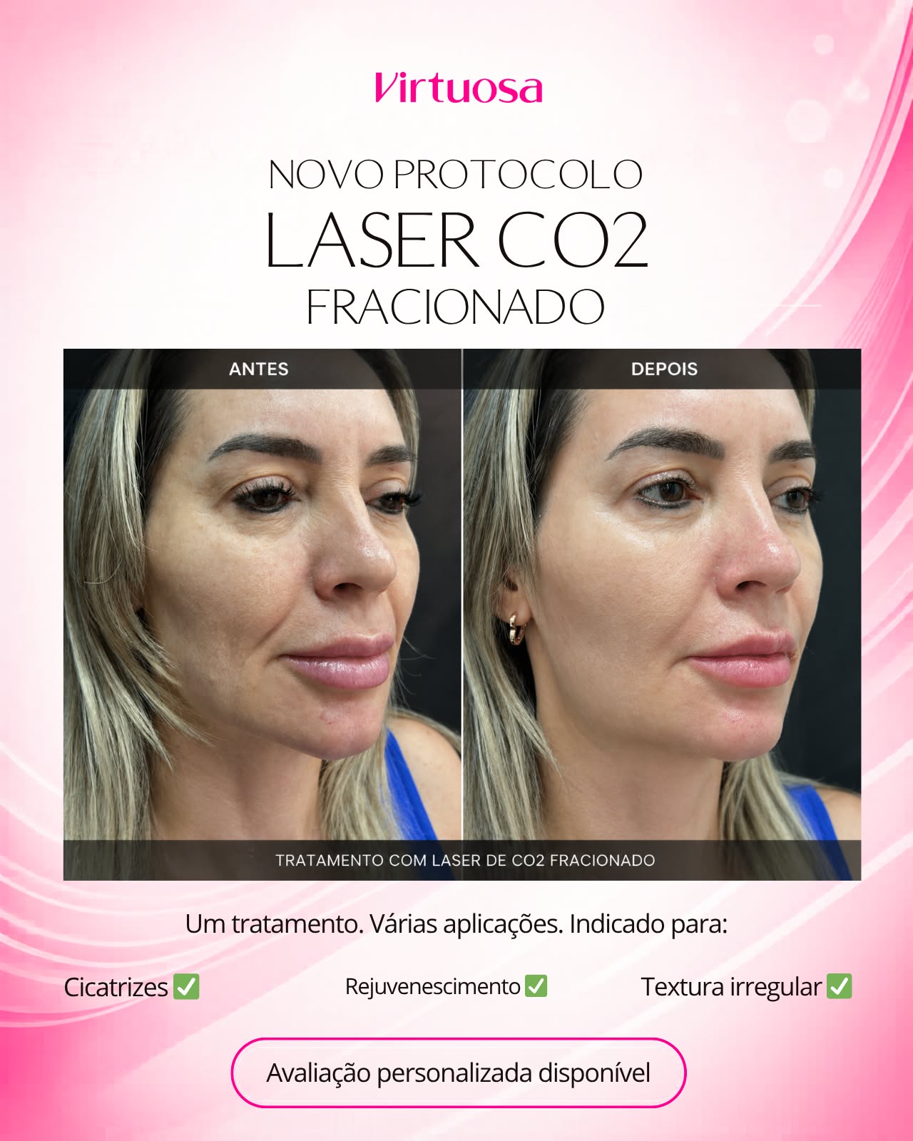 Clínica Virtuosa - Araraquara Facebook ad from May 28, 2026